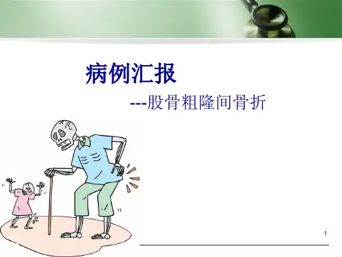 股骨粗隆间骨折病例汇报
