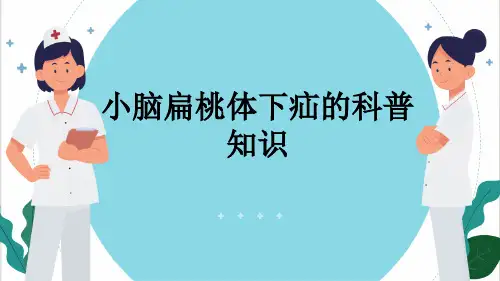 小脑扁桃体下疝的科普知识