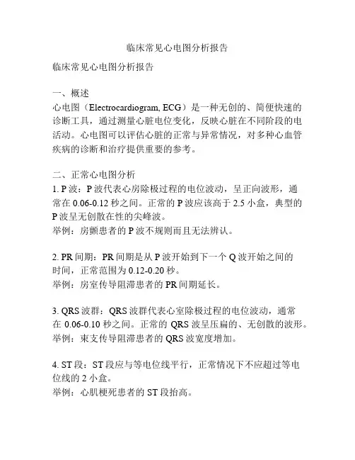 临床常见心电图分析报告