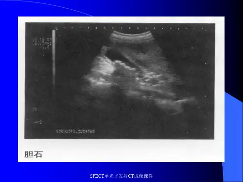 SPECT单光子发射CT成像课件