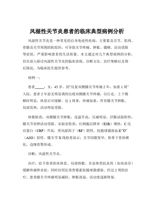 风湿性关节炎患者的临床典型病例分析