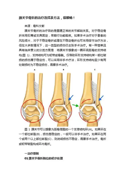踝关节骨折的治疗选择及方法，很顺畅！