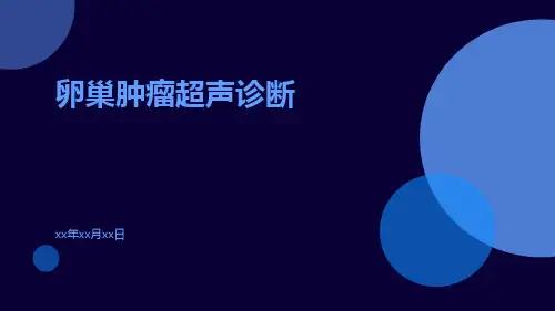 卵巢肿瘤超声诊断