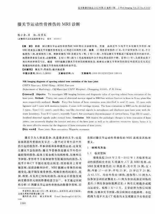 膝关节运动性骨挫伤的MRI诊断