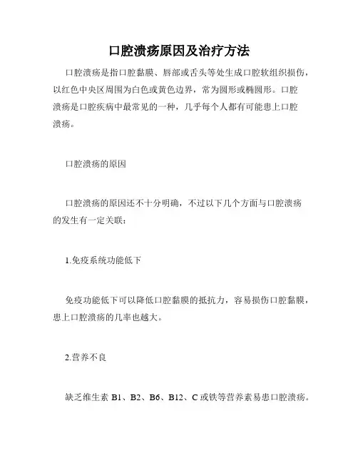 口腔溃疡原因及治疗方法