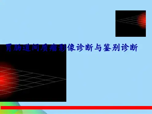 胃肠道间质瘤影像诊断与鉴别诊断上(共44张PPT)