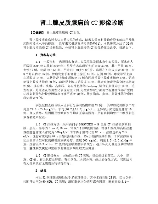 肾上腺皮质腺癌的CT影像诊断