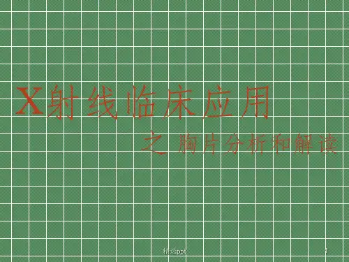 X光摄影的临床应用胸片分析和解读