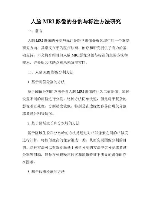 人脑MRI影像的分割与标注方法研究