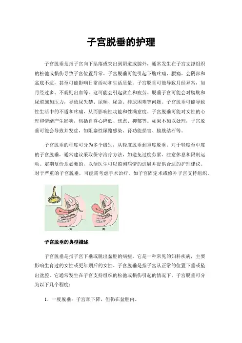 子宫脱垂的护理