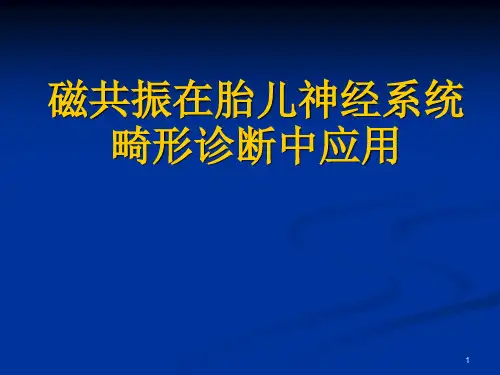 胎儿磁共振诊断ppt课件