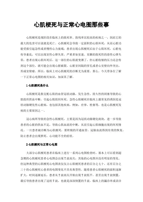 心肌梗死与正常心电图那些事