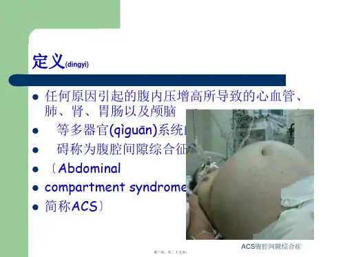 ACS腹腔间隙综合症课件