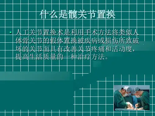 髋关节置换术围手术期的护理