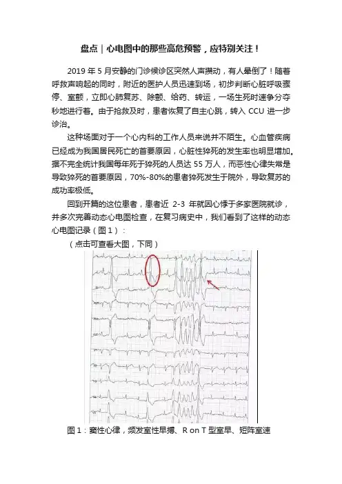 盘点｜心电图中的那些高危预警，应特别关注！
