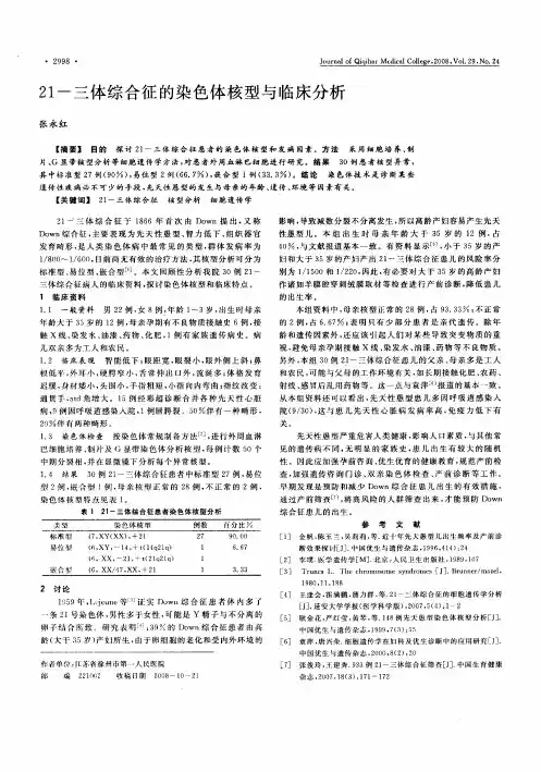 21-三体综合征的染色体核型与临床分析