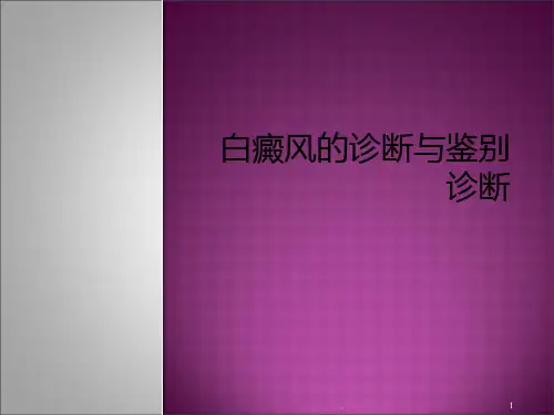 白癜风的鉴别诊断PPT课件
