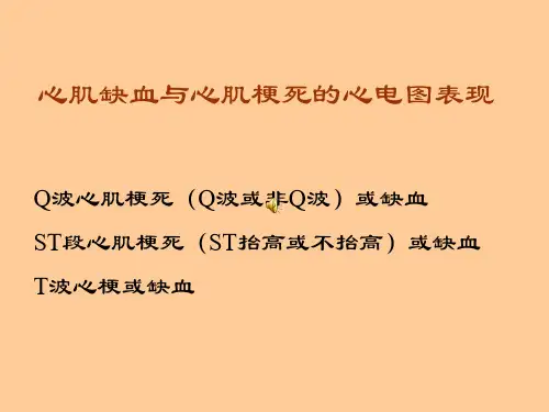心电向量图诊断心肌缺血的