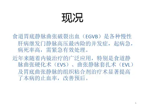 食道胃底静脉曲张破裂出血ppt课件
