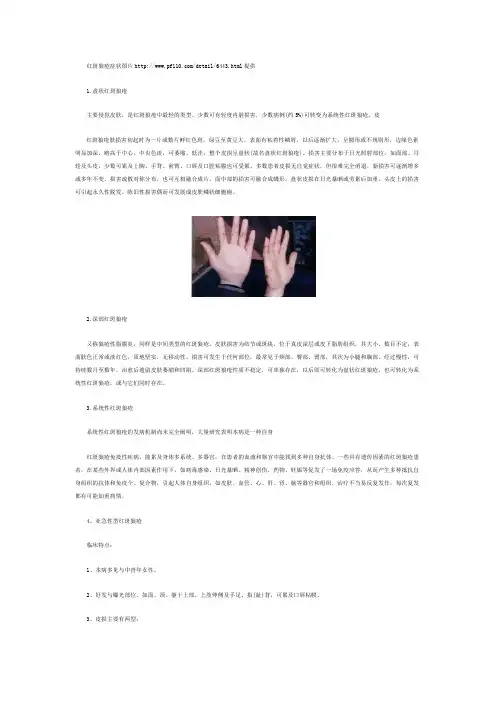 红斑狼疮症状图片