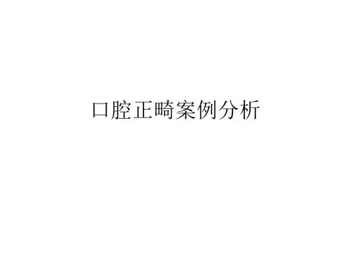 口腔正畸案例分析