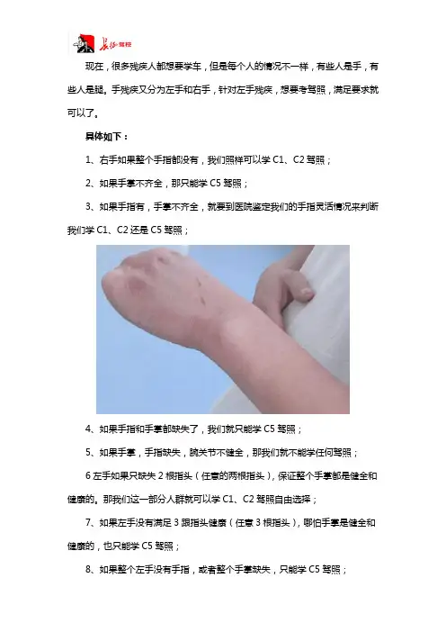 左手残疾能学车吗