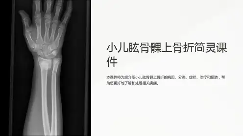 小儿肱骨髁上骨折简灵课件