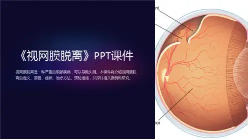 《视网膜脱离》课件