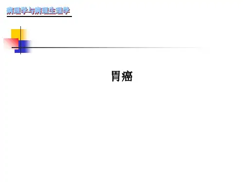 胃癌PPT课件