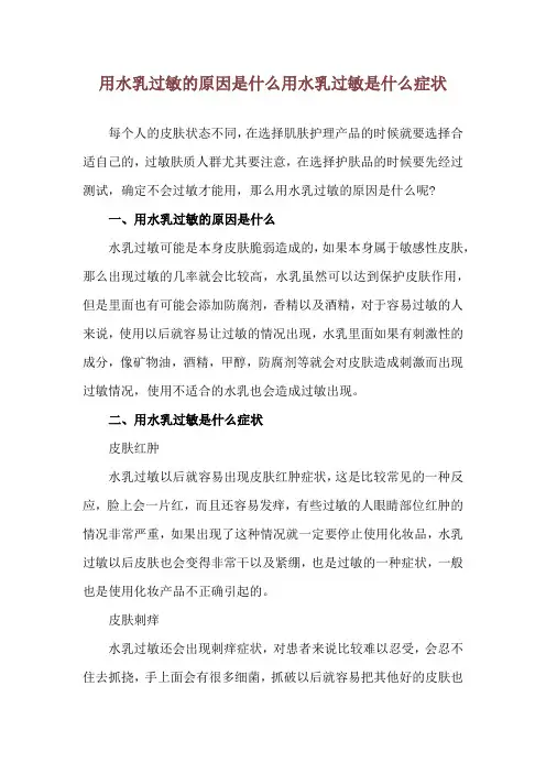 用水乳过敏的原因是什么 用水乳过敏是什么症状