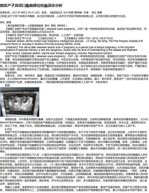 剖宫产子宫切口瘢痕部位妊娠误诊分析