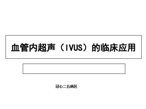 血管内超声 曾繁芳