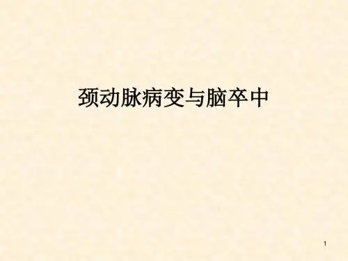 颈动脉病与脑卒中医学PPT课件