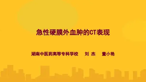 急性硬膜外血肿的CT表现PPT资料优秀版