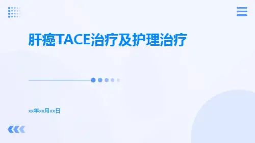 肝癌TACE治疗及护理治疗