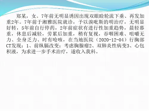 重症肌无力浅析