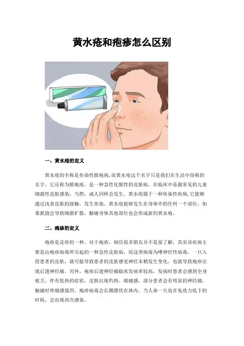 黄水疮和疱疹怎么区别
