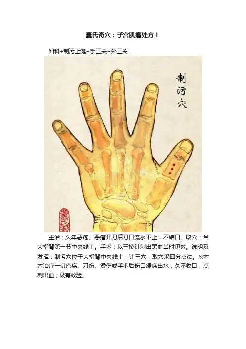 董氏奇穴：子宫肌瘤处方！