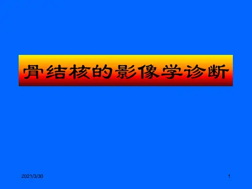 骨结核的影像学表现
