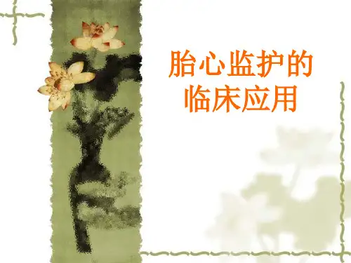 胎心监护的临床运用