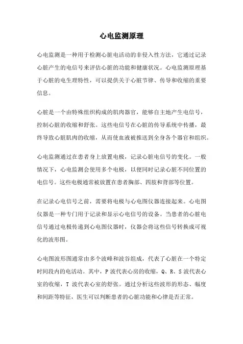 心电监测原理