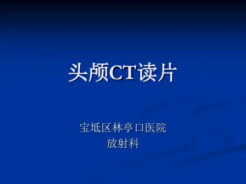 【源版】头颅CT基本知识