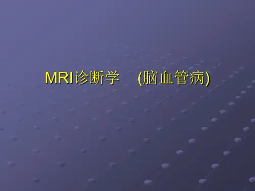 【课件MR】MRI诊断学    (脑血管病)