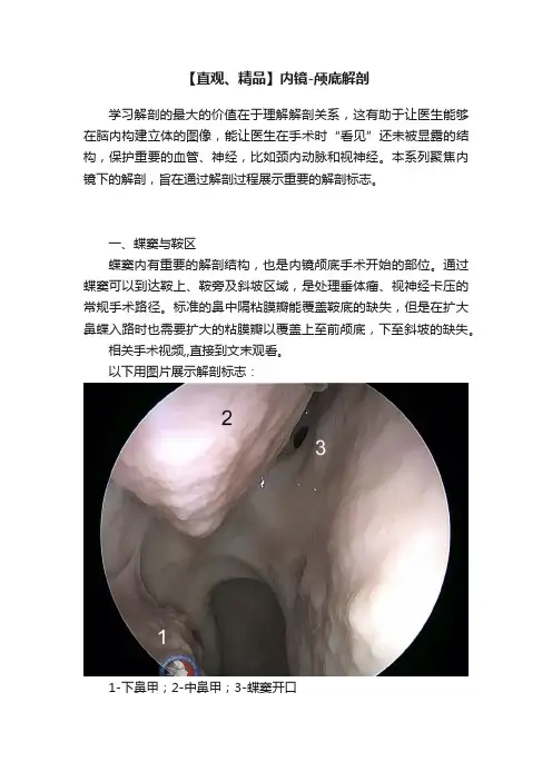 【直观、精品】内镜-颅底解剖