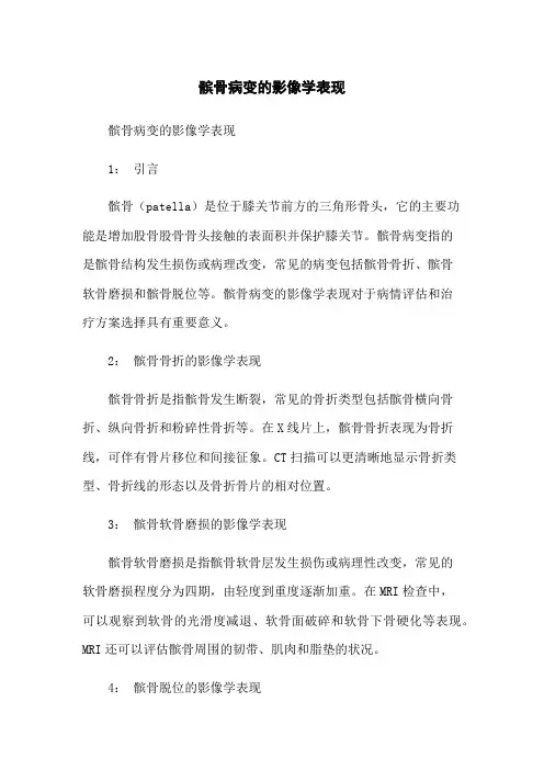 髌骨病变的影像学表现
