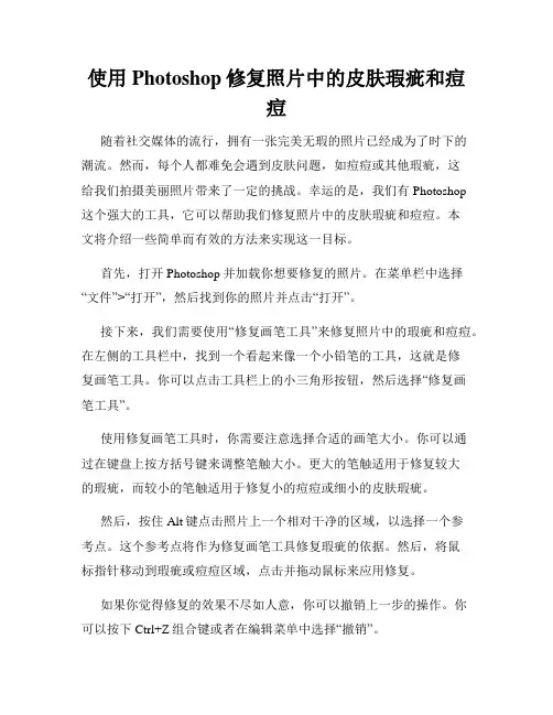 使用Photoshop修复照片中的皮肤瑕疵和痘痘