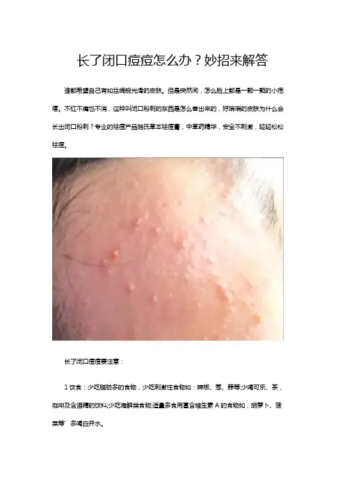 长了闭口痘痘怎么办？妙招来解答