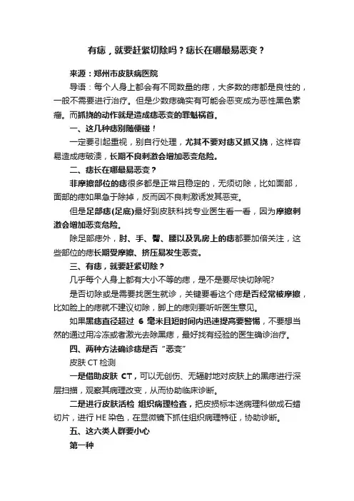 有痣，就要赶紧切除吗？痣长在哪最易恶变？