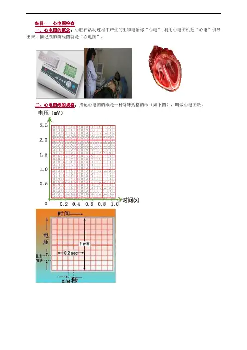 心电图检查知识点归纳