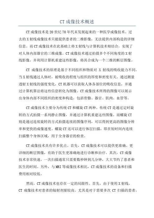 CT成像技术概述